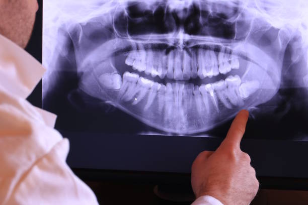 Best Emergency Root Canal Treatment in Santa Rita Ranch, TX