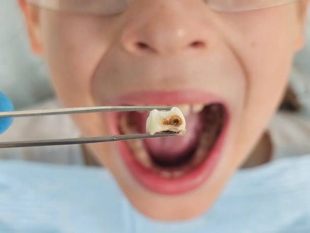 Best Pediatric Emergency Dentist in Santa Rita Ranch, TX