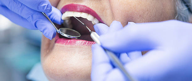 Best Emergency Dental Extractions in Santa Rita Ranch, TX