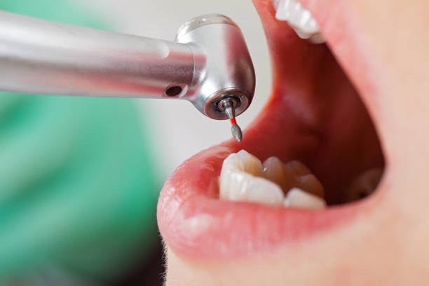  Santa Rita Ranch, TX Emergency Dentist Pros